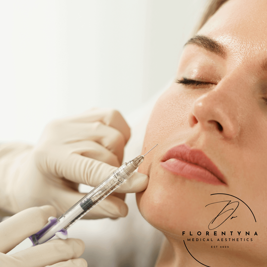 dermal filler injectable treatment