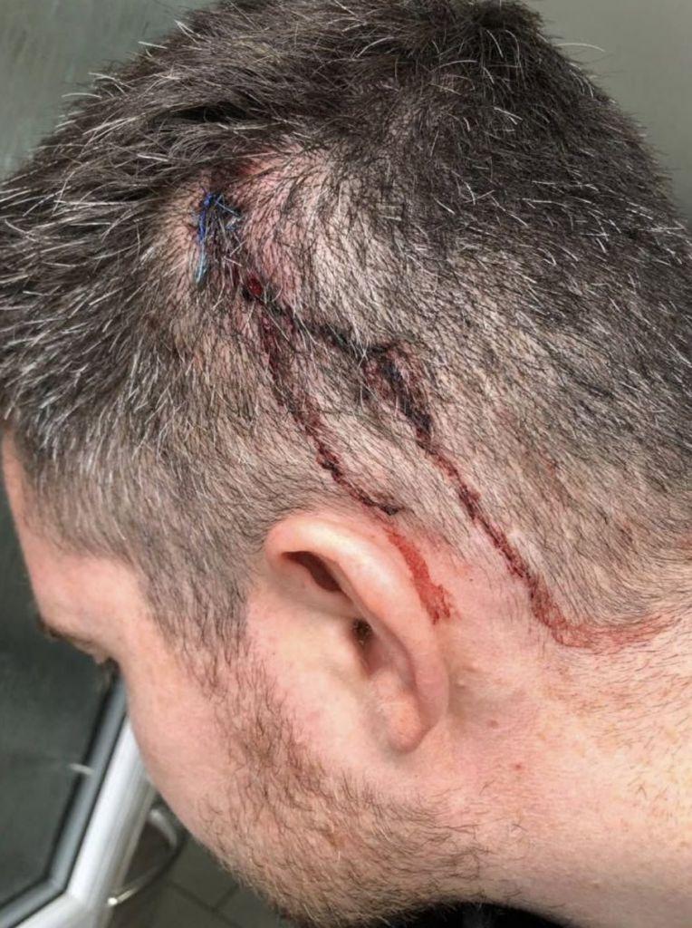 Rangers Fan gets Jailed for 12 months after Celtic Physio Assault